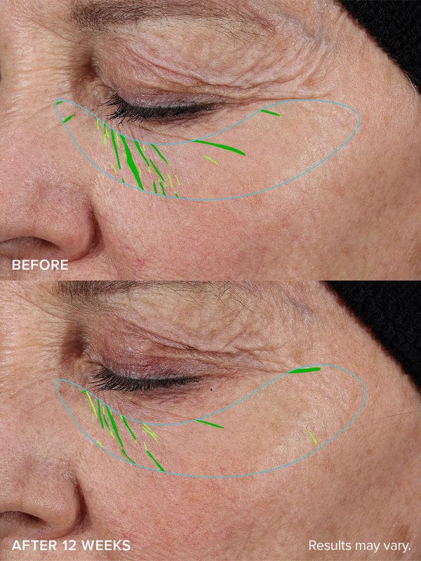 Needle-less® Growth Factor Serum - Image 4